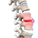 :xf_spine: