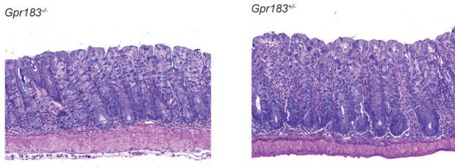 Two images illustrating how T cell expression of GPR183 does not play a role in the transfer colitis model. Both are H&E staining of representative colon sections (middle part of whole colon) at 40x (scale bar 100 μm) magnification.