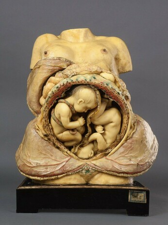 A wax model of a woman's torso that has been dissected to reveal twins insider the uterus.