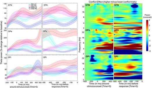 Task-evoked neuronal response. Left: Stimulus-induced mean changes (solid/dotted bold lines) in theta power (4–8 Hz) by condition. Right: Time frequency plots show a task-evoked increase in LFO power (averaged across channels) relative to baseline. Spectra are shown for high minus low conflict (averaged across coherence) aligned to stimulus onset (left panel) and response (right panel) for each basal ganglion component (STN – subthalamic nucleus; GPe – globus pallidus externus; GPi – globus pallidus internus).