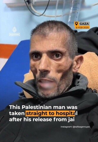 Screenshot van een video van een dit weekend vrijgelaten, door de Israeli Destruction Forces gegijzelde, Palestijnse man. Zijn gezicht is extreem ingevallen. Op de foto is al naar het ziekenhuis gebracht.

Israëlische bewakers van gegijzelden zijn afschuwelijke monsters. Een gigantische pot verwijnt een klein keteltje dat zij zwart is - m.b.t. de aanslag van 7 oktober 2023.

Israël heeft Palestijnen van hun land verdreven, gemarteld, verkracht en/of vermoord sinds 1948. Een afschuwelijk "langzaam" stelletje fascisten zijn het.

Gesteund door de Nederlandse regering, die daarmee ronduit medeplichtig is aan genocide.