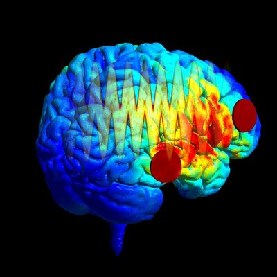 The image shows the distribution of the electric field, simulated in SimNIBS, on the reconstructed brain of a healthy human participant. Red circles show the position of the electrodes on the right hemisphere. Overlaid is a spectrogram of one of the auditory stimuli used in the study. Image Credit: Yuranny Cabral-Calderin