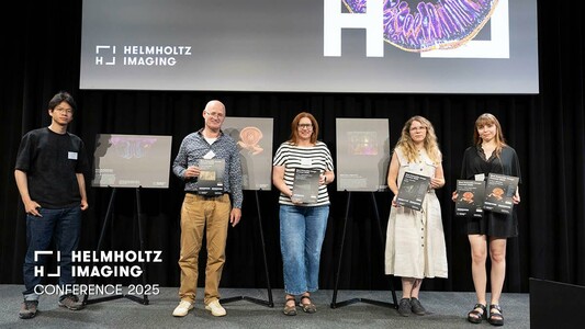 Winners of Helmholtz Imaging Best Scientific Image Contest 2025