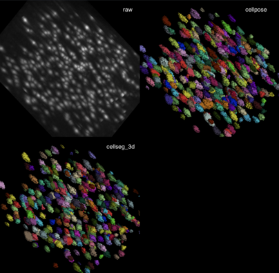 3D view: raw data (upper left), Cellpose segmentation (upper right), CellSeg3D segmentation (lower left)
