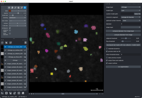 Cellpose segmentation and applied parameters