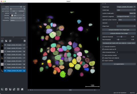 Cellpose segmentation and applied parameters