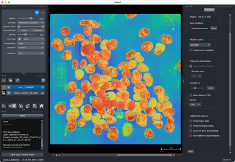 CellSeg_3D segmentation and applied parameters