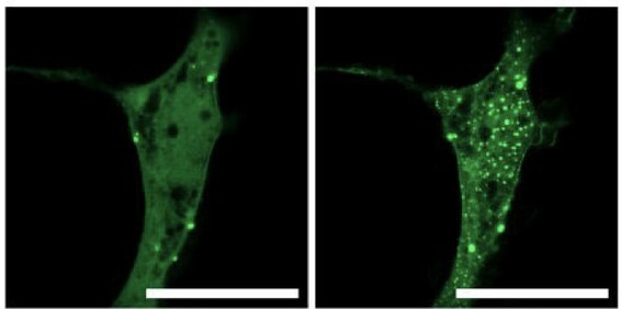 Cells expressing Yap (stained green). Left side without  condensate induction, right side two minutes after condensate induction, now filled with green dots.
