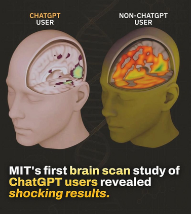 MIT brain scan