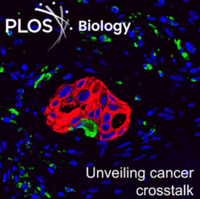 The image shows immunofluorescence staining of human bone metastases sections showing cancer cells marked by CK8/CK19 (red), macrophages labeled with CD68 (green), and nuclei counterstained with DAPI (blue).

Image Credit: Yujiao Han and Yibin Kang, Princeton University
