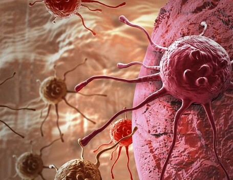 Low dose of aspirin cuts recurrence risk in colorectal cancer with genetic mutation