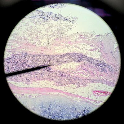 Mammal elastic cartilage.