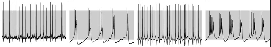 Example of four electrophysiological traces from corticotrophs (2 males and 2 females) showing different firing patterns (spiking vs bursting). From Figure 3 of Duncan et al. 2023 - "Sex differences in pituitary corticotroph excitability"